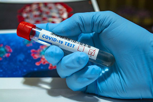 Coronavirus Test Postive  554