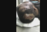 Osei receiving treatment at the hospital