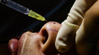 Cosmetic surgery has become popular in today's world