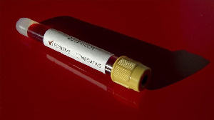 A Photo Of A COVID 19 Test