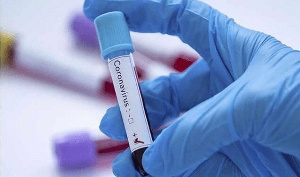 Coronavirus Test