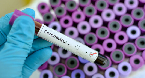 Coronavirus testing labs raised to 80% minimum