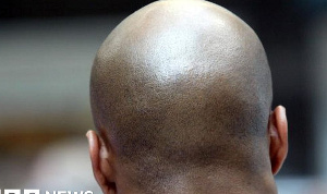 File photo of a bald black man