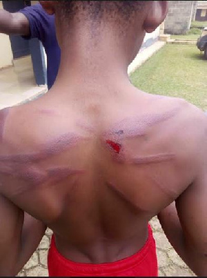 A picture of Antwi with cane injuries on his back