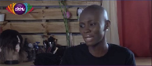 Lahadi Samira was born with a medical condition; Alopecia areata also known as spot baldness