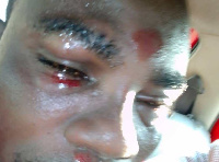 File photo: Communications Manager for the Independent Candidate Seth Oduro was assaulted