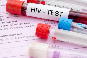 People living with HIV in 2019 totalled 339,727 but rose to 345,534 in 2020