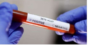 Coronavirus   Positive And Negative