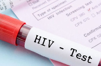 File photo/HIV