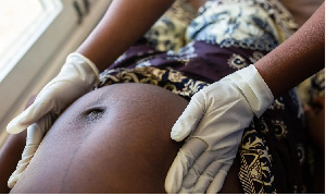 A nurse attending to a pregnant woman