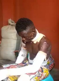 22 -year -old, Kojo Ampong was burnt for allegedly stealing a phone