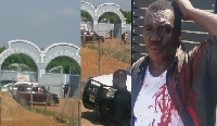 A member of the Assembly allegedly assaulted with blood stains on his shirt (R)