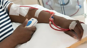 File photo, a paitent undergoing dialysis