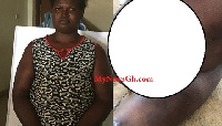 The victim was subjected to flogging by her mother who accused her of being a witch