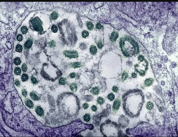 Marburg Virus