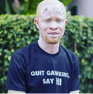 Kwame Andrews Daklo is a person living with albinism