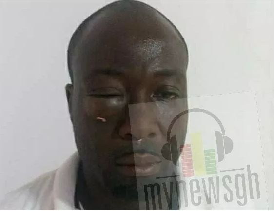 Assaulted journalist Reynold Dadzie,