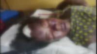 The woman is receiving treatment at Awutu Breku Hospital