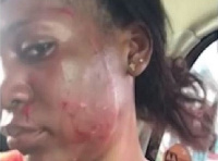 Francisca Quaye, Lady allegedly assaulted by baby daddy