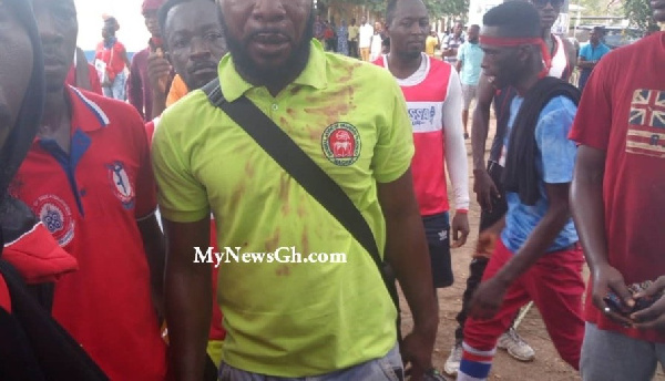 An injured man with blood stains on his shirt