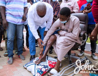 Former President John Dramani Mahama inspecting the scars of one of the victims