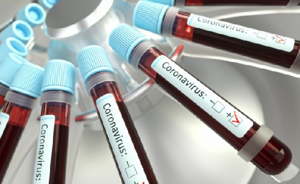 File photo: Coronavirus samples