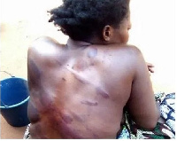 29-year-old Mary Ama Nyorkey was beaten mercilessly by her boyfriend