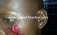 Three people were wounded on Friday, 29 June 2019 after supporters of the NPP and NDC clashed