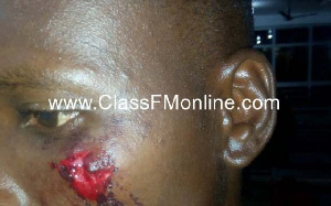 Three people were wounded on Friday, 29 June 2019 after supporters of the NPP and NDC clashed