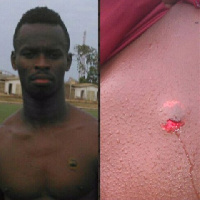 Stephen Amankwah showing the injury