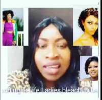 Lovelyn Azuka said bleaching is a great way for ugly ladies to be beautiful