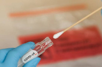 File photo of COVID-test swab kit