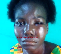 27-year-old Gloria Eshun was beaten severely by her sister’s husband