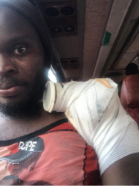 Yahaya Mohamed has been playing on the injured shoulder in the ongoing Ghana Premier League