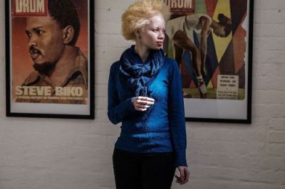 S.African model Thando Hopa revels in her albino skin