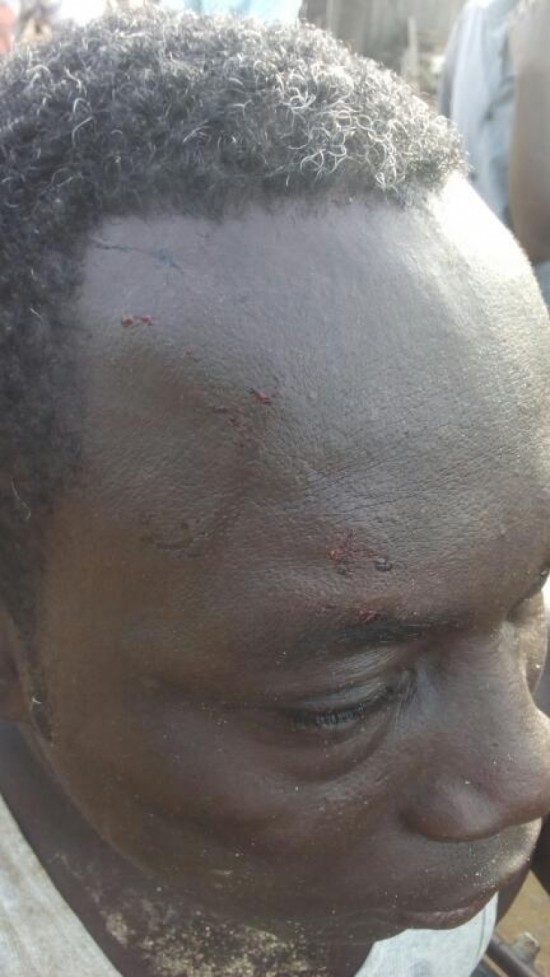 A victim with injuries on his head.