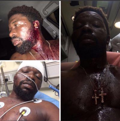 GRAPHIC: Criss Waddle’s boy mercilessly beaten up in USA