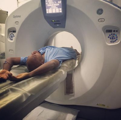 Actor Charles Okocha shares graphic photos of his bullet wounds